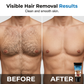 📢📢50% OFF !! ⏰Men's Gentle Hair Removal Cream