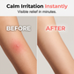 📢📢50% OFF !! ⏰Portable Mosquito Insect Bite Relieve Itching Pen
