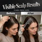 📢📢BUY 1 GET 1 FREE！！⏰Scalp Applicator Comb Tool for Hair